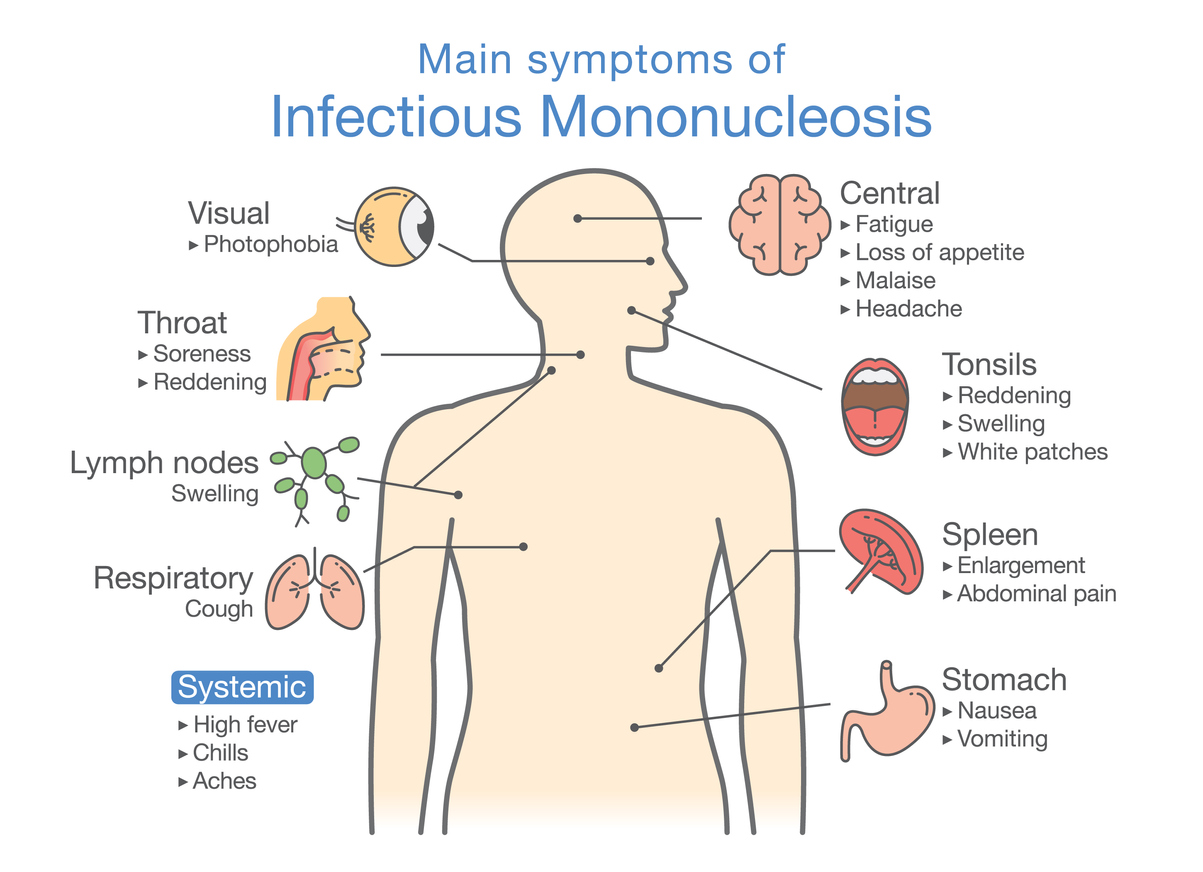 10-ways-to-prevent-mono-mononucleosis